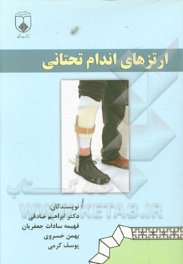 ارتزهای اندام تحتانی