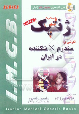 نگرشی بر: سندرم X شکننده در ایران