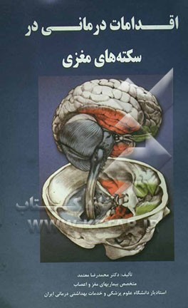 اقدامات درمانی در سکته‌های مغزی