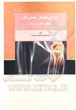 جراحی تعویض مفصل زانو و مراقبت‌های پس از آن