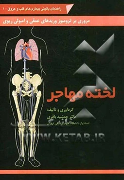 لخته مهاجر: مروری بر ترومبوز وریدهای عمقی و آمبولی ریوی
