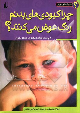 چرا کبودی‌های بدنم رنگ عوض می‌کنند؟ و پرسش‌های دیگری درباره‌ی خون