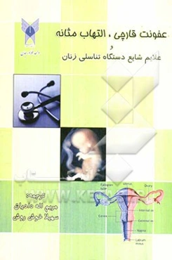 عفونت قارچی، التهاب مثابه و علایم شایع دستگاه تناسلی زنان