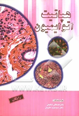 هپاتیت اتوایمیون