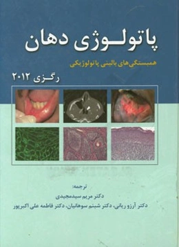 پاتوبیولوژی دهان رگزی