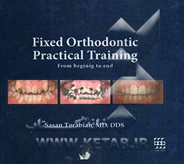 Fixed orthodontic practical training from the beginning to the end
