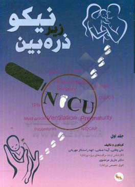 نیکو NICU زیر ذره‌بین