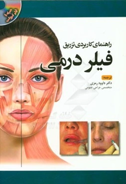 راهنمای کاربردی تزریق فیلر درمی