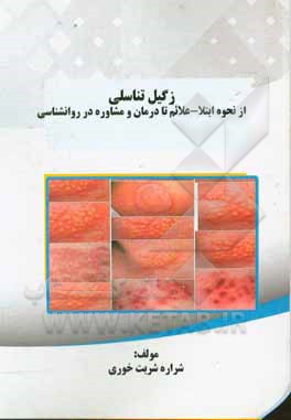 زگیل تناسلی: از نحوه ابتلا - علائم تا درمان و مشاوره در روانشناسی