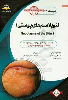 پوست: نئوپلاسم‌های پوستی‏‫ (1): خلاصه درس به همراه مجموعه سوالات آزمون ارتقاء و بورد پوست با پاسخ تشریحی Bolognia Dermatology 2012: کتاب آمادگی آزمون