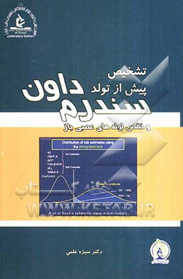 تشخیص پیش از تولد سندرم داون و نقص لوله‌های عصبی باز