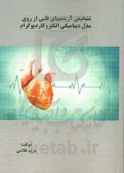 تشخیص آریتمی‌های قلبی از روی مدل دینامیکی الکتروکاردیوگرام