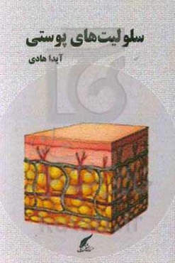 مقاله کوتاه سلولیت‌های پوستی