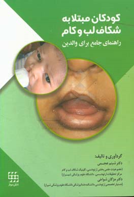 کودکان مبتلا به شکاف لب و کام: راهنمای جامع برای والدین