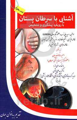 آشنایی با سرطان پستان (با رویکرد پیشگیری و تشخیص)