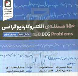 150 مسئله الکتروکاردیوگرافی