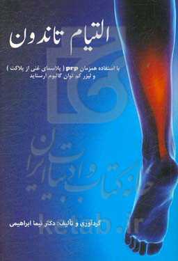 التیام تاندون با استفاده همزمان از PRP (پلاسمای غنی از پلاکت) و لیزر کم‌توان گالیوم آرسناید