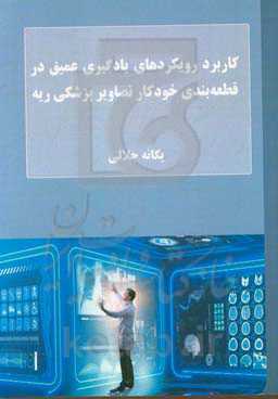 کاربرد رویکردهای یادگیری عمیق در قطعه‌بندی خودکار تصاویر پزشکی ریه