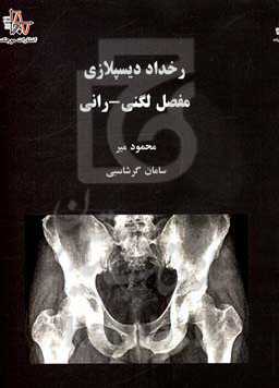 رخداد دیسپلازی مفصل لگنی - رانی