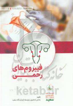 فیبروم‌های رحمی