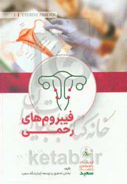 فیبروم‌های رحمی