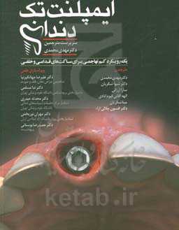 ایمپلنت تک‌دندانی رویکرد کم‌تهاجم برای ساکت‌های قدامی و خلفی