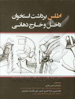 اطلس برداشت استخوان داخل و خارج دهانی