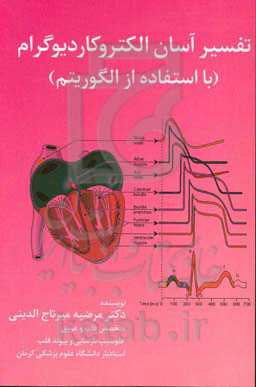 تفسیر آسان الکتروکادیوگرام با استفاده از الگوریتم