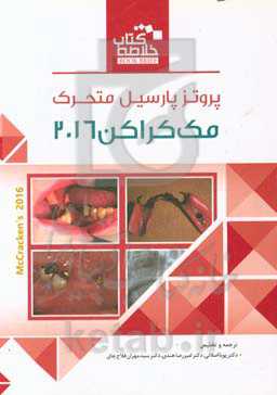 پروتزهای پارسیل متحرک مک کراکن 2016