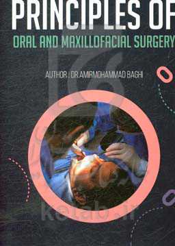 Principles of oral and maxillofacial surgery