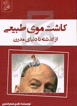 کاشت موی طبیعی از گذشته تا دنیای مدرن