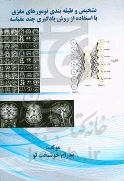 تشخیص و طبقه‌بندی تومورهای مغزی با استفاده از روش یادگیری چند مقایسه