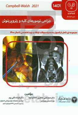 جراحی تومورهای کلیه و رتروپریتوئن: خلاصه درس به‌همراه مجموعه سوالات آزمون ارتقاء و بورد با پاسخ تشریحی اورولوژی تا سال 1400: Campbell- Walsh-Wein urology