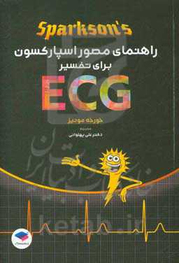 راهنمای مصور اسپارکسون ECG