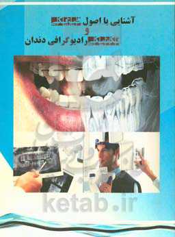 آشنایی با اصول فیزیکی و تکنیکی رادیوگرافی دندان