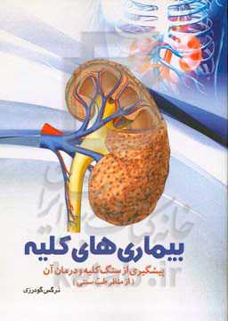 بیماری‌های کلیه: پیشگیری از سنگ کلیه و درمان آن (از منظر طب سنتی)