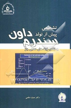 تشخیص پیش از تولد سندرم داون و نقص لوله‌های عصبی باز