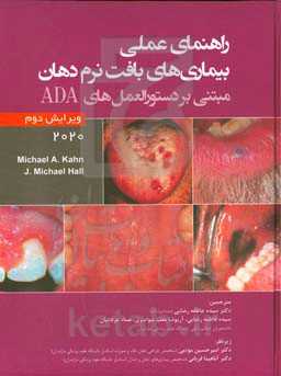 راهنمای عملی بیماری‌های بافت نرم دهان مبتنی بر دستورالعمل‌های ADA