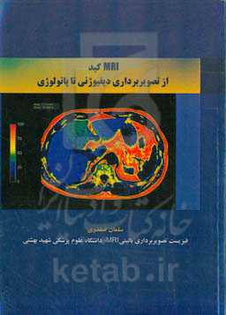 MRI کبد از تصویربرداری دیفیوژنی تا پاتولوژی