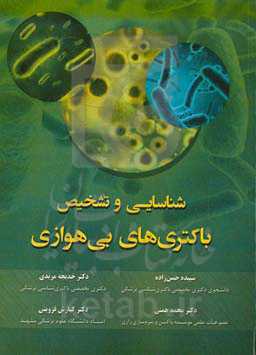 شناسایی و تشخیص باکتری‌های بی‌هوازی