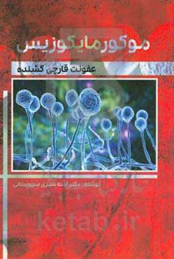 موکورمایکوزیس (عفونت قارچی کشنده)