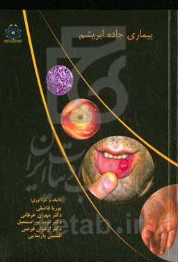 بیماری جاده ابریشم