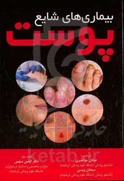 بیماری‌های شایع پوست