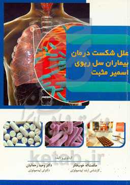 علل شکست درمان بیماران سل ریوی اسمیر مثبت