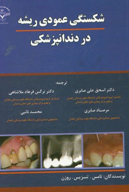 شکستگی عمودی ریشه در دندانپزشکی