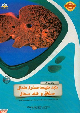 پاتولوژی: کبد، کیسه صفرا، طحال، صفاق و خلف صفاق: خلاصه درس به همراه مجموعه سوالات آزمون ارتقاء و بورد پاتولوژی با پاسخ تشریحی