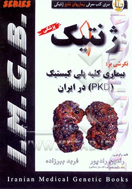 ژنتیک نگرشی بر: بیماری کلیه پلی کیستیک (PKD) در ایران