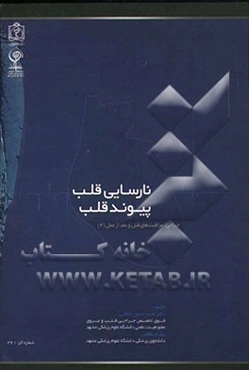 نارسایی قلب - پیوند قلب