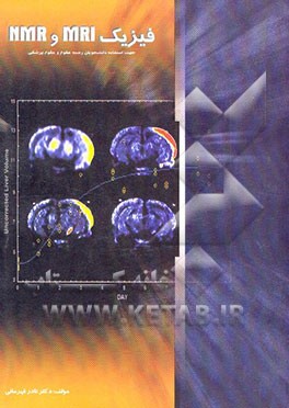 تصویرنگاری تشدید مغناطیسی (MRI) و فیزیک تشدید مغناطیسی هسته‌ای (NMR) "جهت استفاده ...