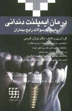 پاسخ به سوالات رایج بیماران درمان ایمپلنت دندانی